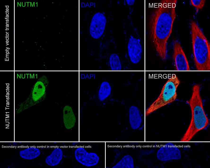 NUT Antibody (PSH03-36)