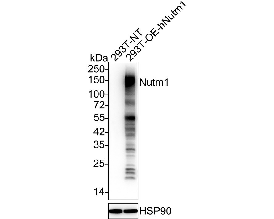 NUT Antibody (PSH03-37) Western Blot: NUT Antibody (PSH03-37) [NBP3-32675]