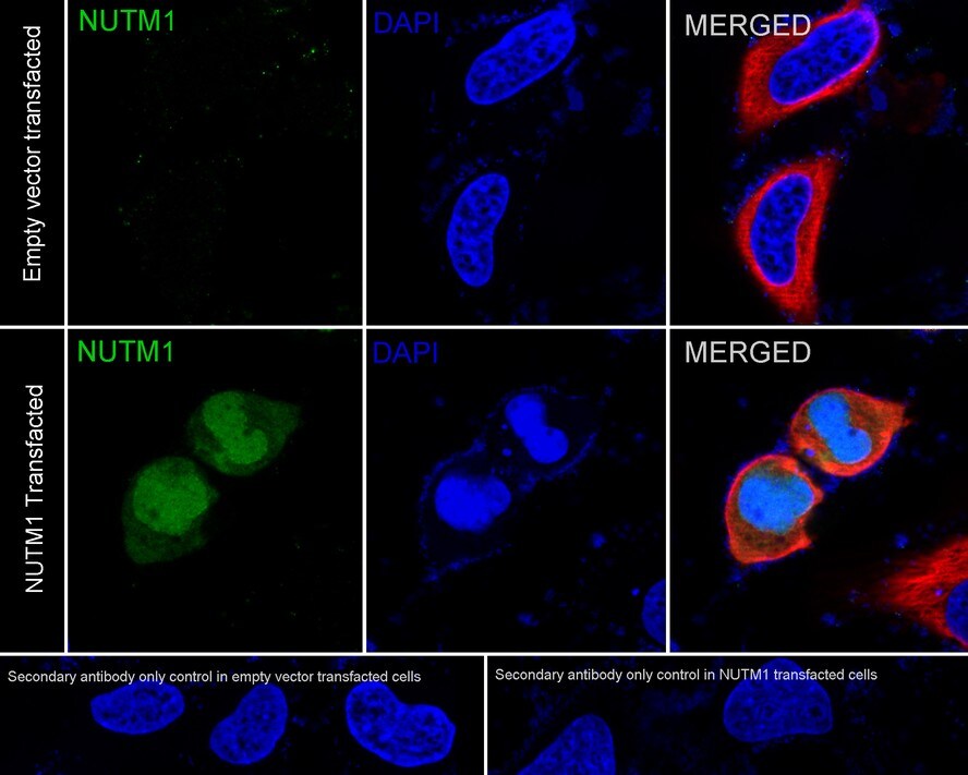 NUT Antibody (PSH03-37)