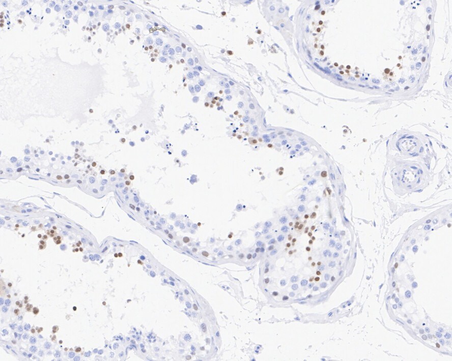 NUT Antibody (PSH03-37)