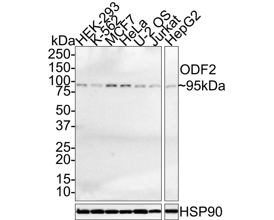 ODF2 Antibody (JE35-01)