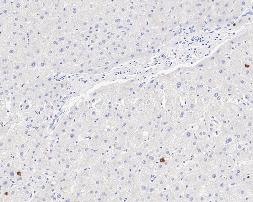 OLFM4 Antibody (PSH01-37)