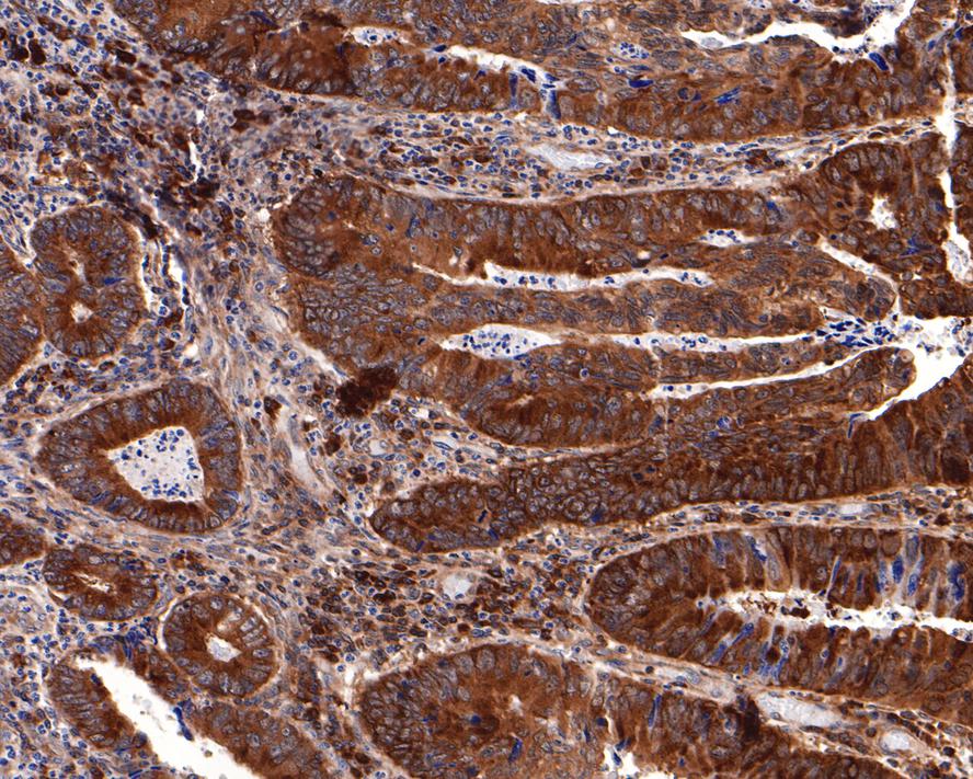 Oncostatin M/OSM Antibody (JE40-04)