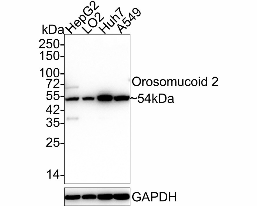 Orosomucoid 2 Antibody Western Blot: Orosomucoid 2 Antibody [NBP3-32680]