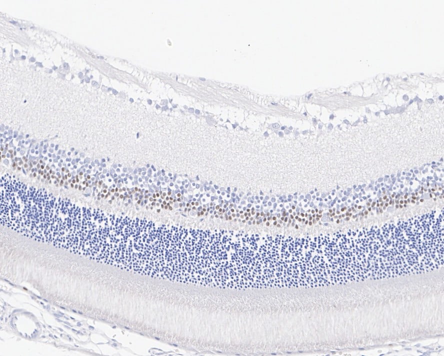 Otx1/2 Antibody (PSH01-62)
