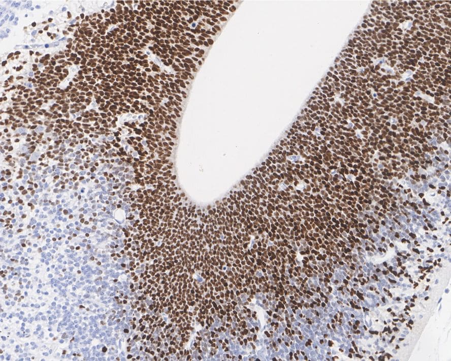Otx2 Antibody (PSH01-61)