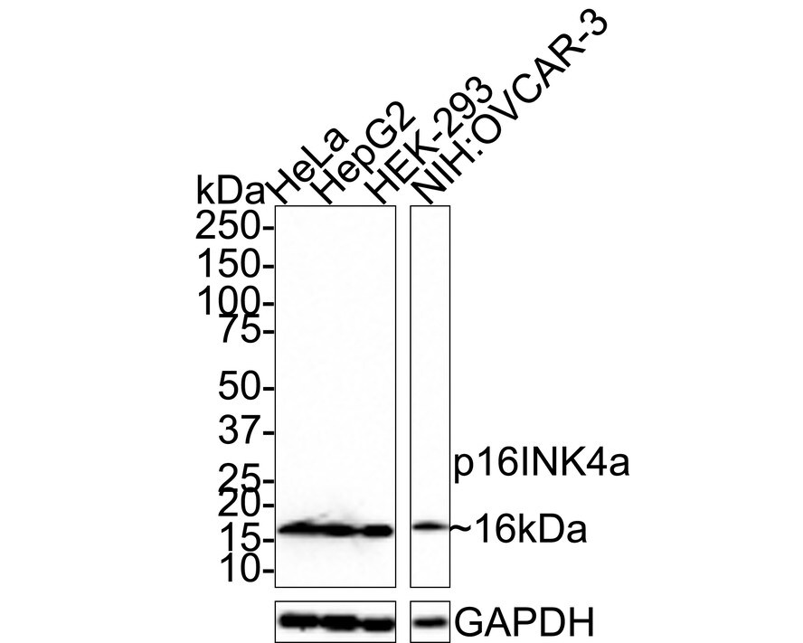 p16INK4a/CDKN2A Antibody (PD01-16) Western Blot: p16INK4a/CDKN2A Antibody (PD01-16) [NBP3-32688]