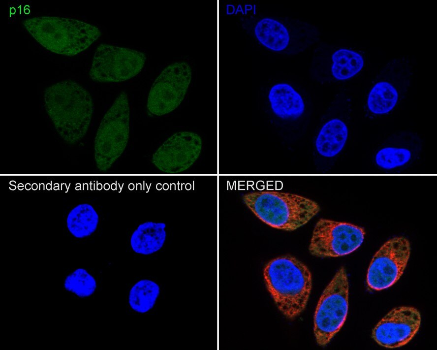 p16INK4a/CDKN2A Antibody (PD01-16)