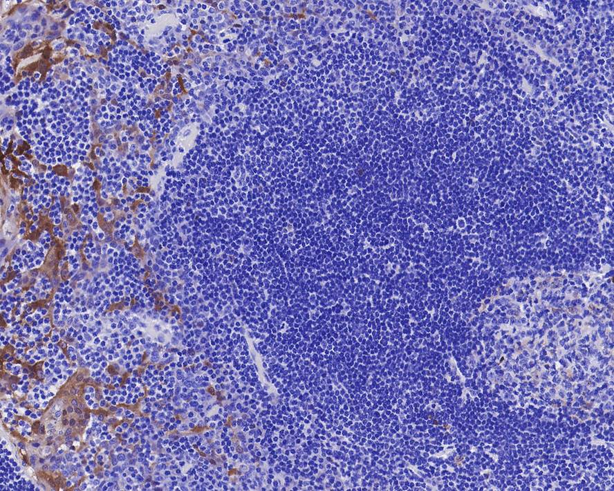 p16INK4a/CDKN2A Antibody (PD01-16)