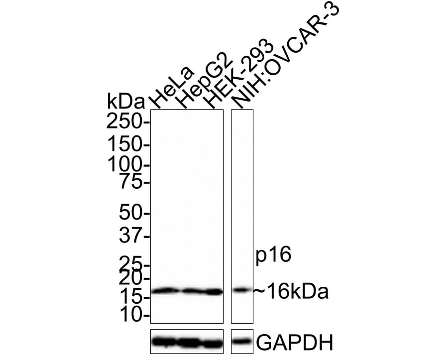 p16INK4a/CDKN2A Antibody (PD01-16)