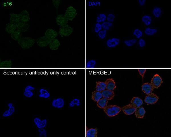 p16INK4a/CDKN2A Antibody (PD01-16)