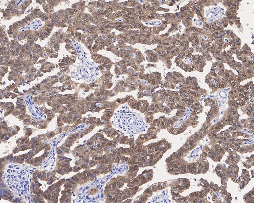 p16INK4a/CDKN2A Antibody (PD01-16)