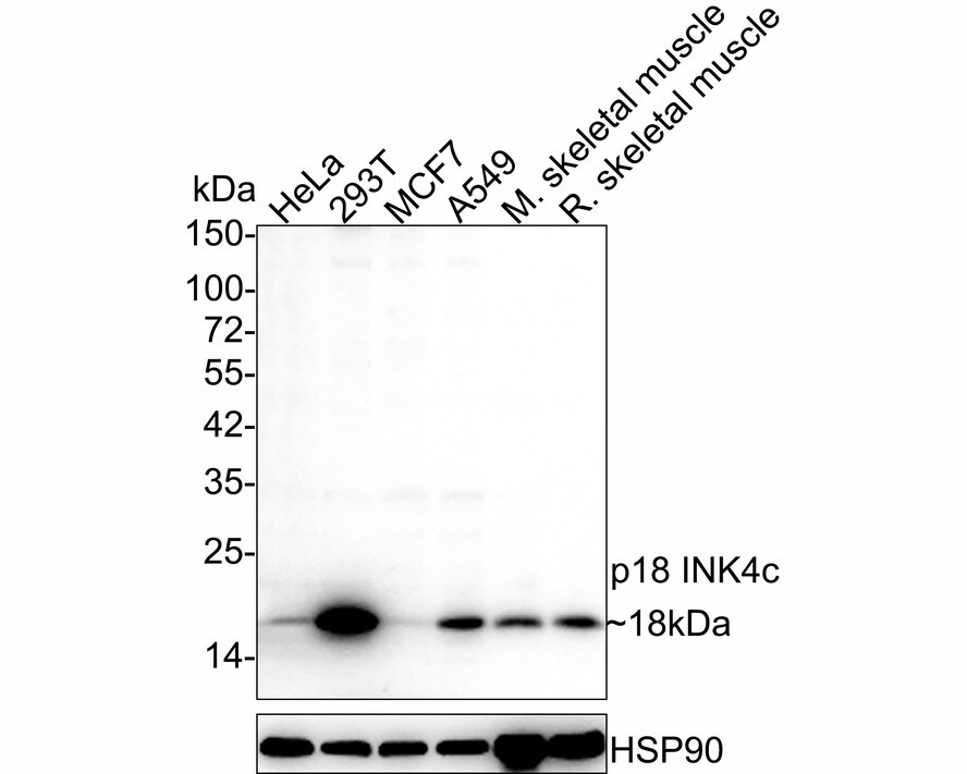 p18INK4c/CDKN2C Antibody (JE36-09) Western Blot: p18INK4c/CDKN2C Antibody (JE36-09) [NBP3-32690]