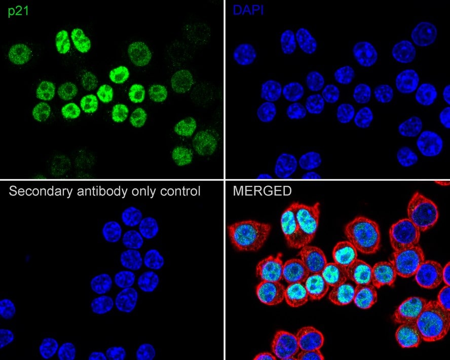 p21/CIP1/CDKN1A Antibody (PSH03-93)