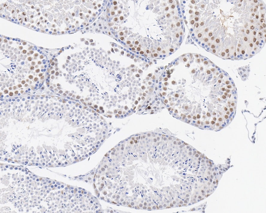 p21/CIP1/CDKN1A Antibody (PSH03-93)