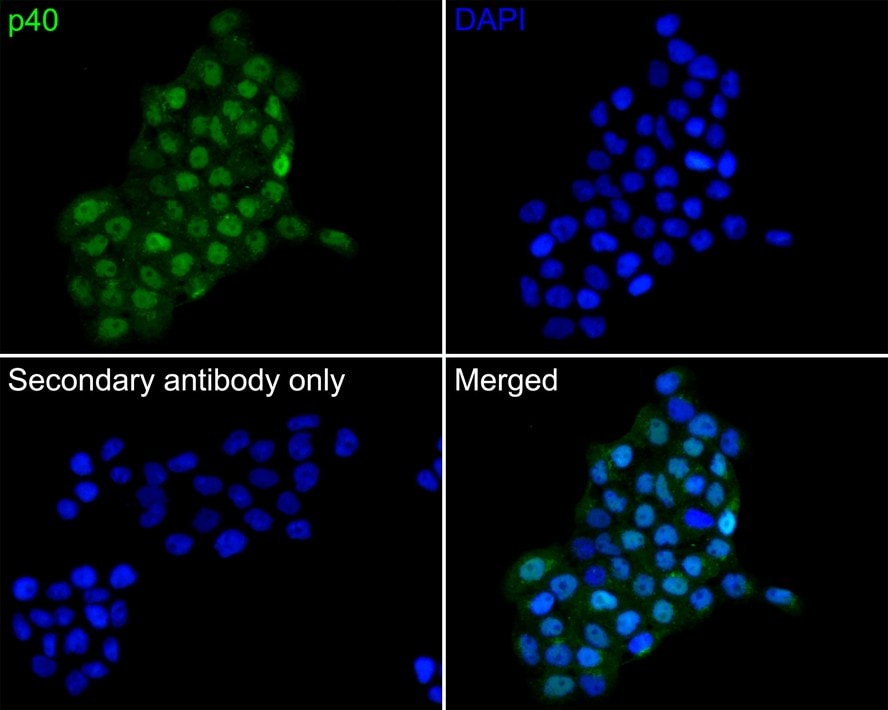p40/deltaNp63 Antibody (PDH0-02)