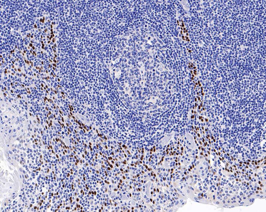 p40/deltaNp63 Antibody (PDH0-02)