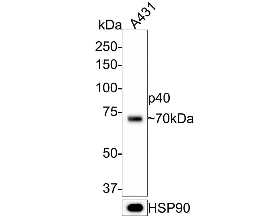 p40/deltaNp63 Antibody (PDH0-06)