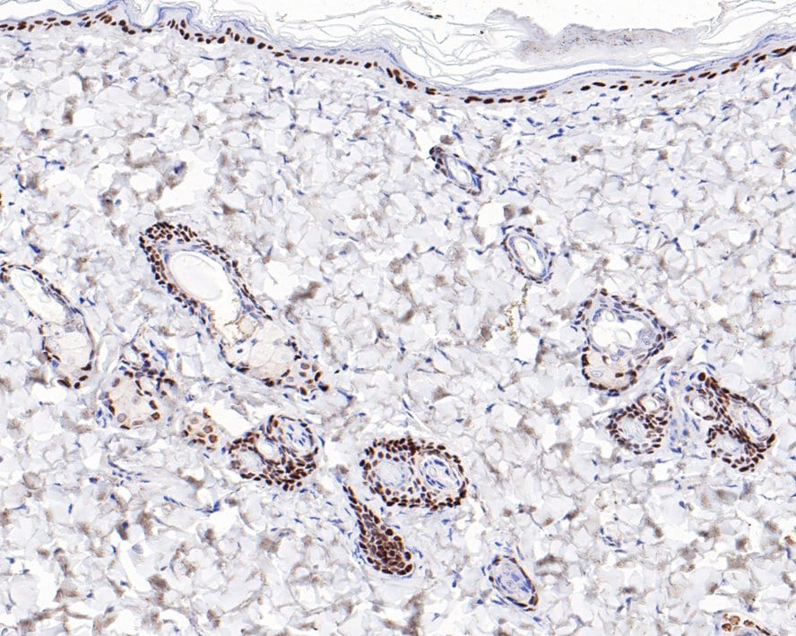 p40/deltaNp63 Antibody (PDH0-06)
