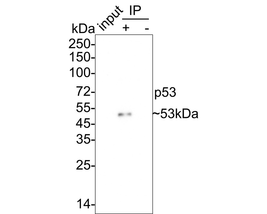 p53 Antibody (PSH03-95)