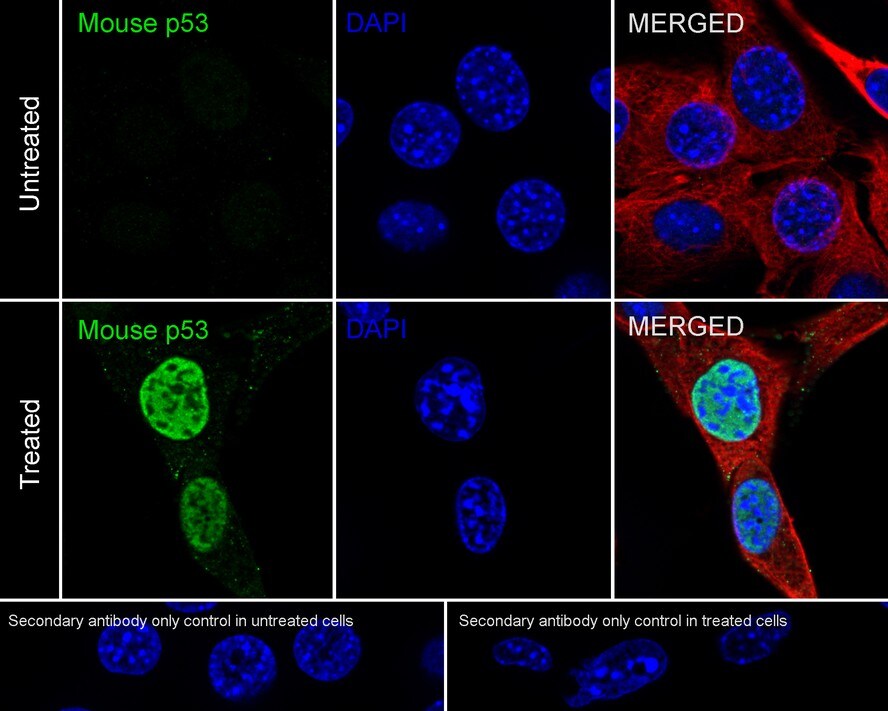 p53 Antibody (PSH03-95)