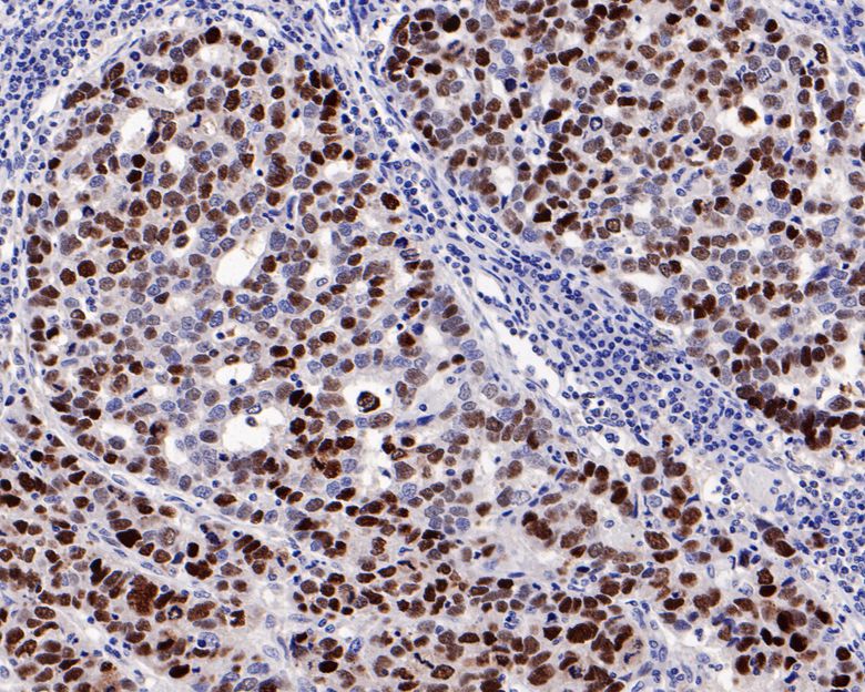 p53 Antibody (PD01-32)