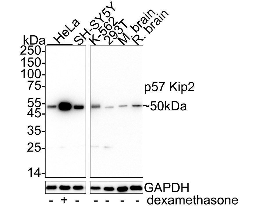 p57 Kip2 Antibody (JE02-08) Western Blot: p57 Kip2 Antibody (JE02-08) [NBP3-32701]