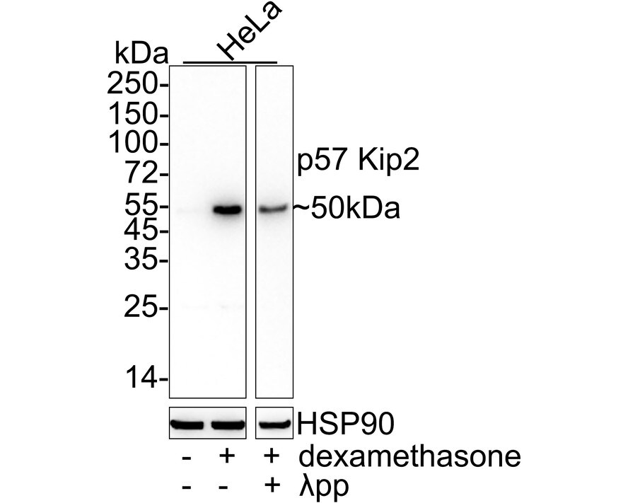 p57 Kip2 Antibody (JE02-08) Western Blot: p57 Kip2 Antibody (JE02-08) [NBP3-32701]