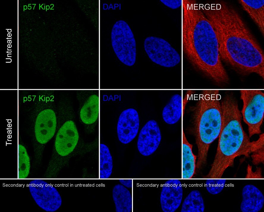 p57 Kip2 Antibody (JE02-08)