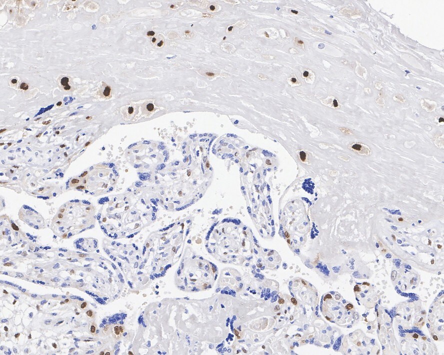 p57 Kip2 Antibody (JE02-08)