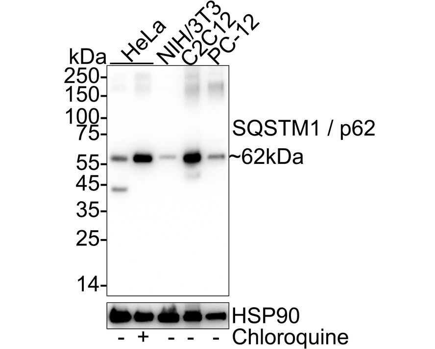 p62/SQSTM1 Antibody (PS00-61) Western Blot: p62/SQSTM1 Antibody (PS00-61) [NBP3-32702]