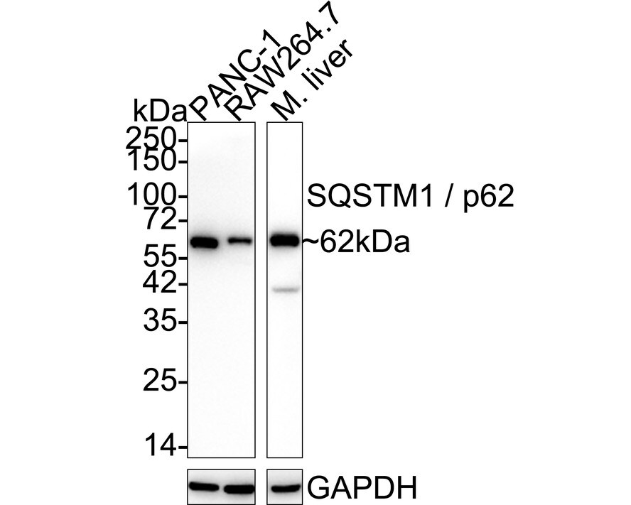 p62/SQSTM1 Antibody (PS00-61) Western Blot: p62/SQSTM1 Antibody (PS00-61) [NBP3-32702]
