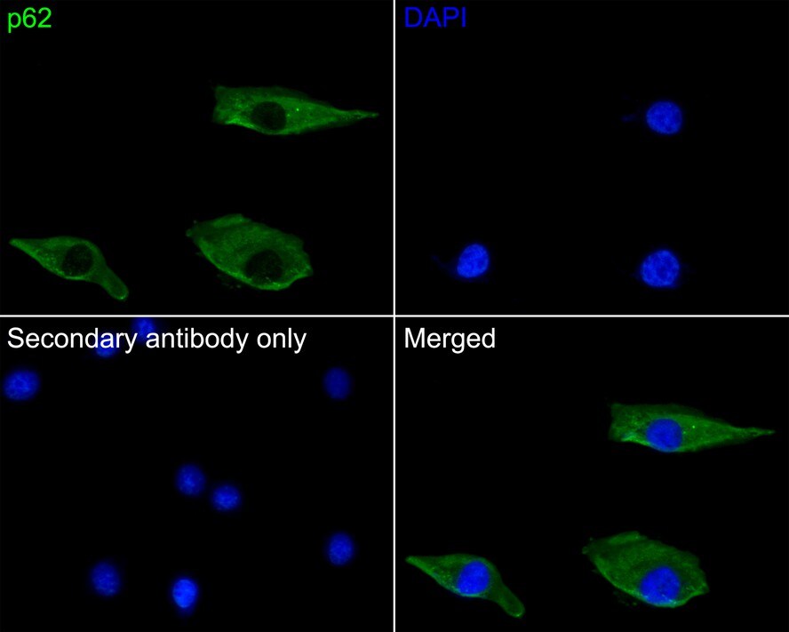 p62/SQSTM1 Antibody (PS00-61)