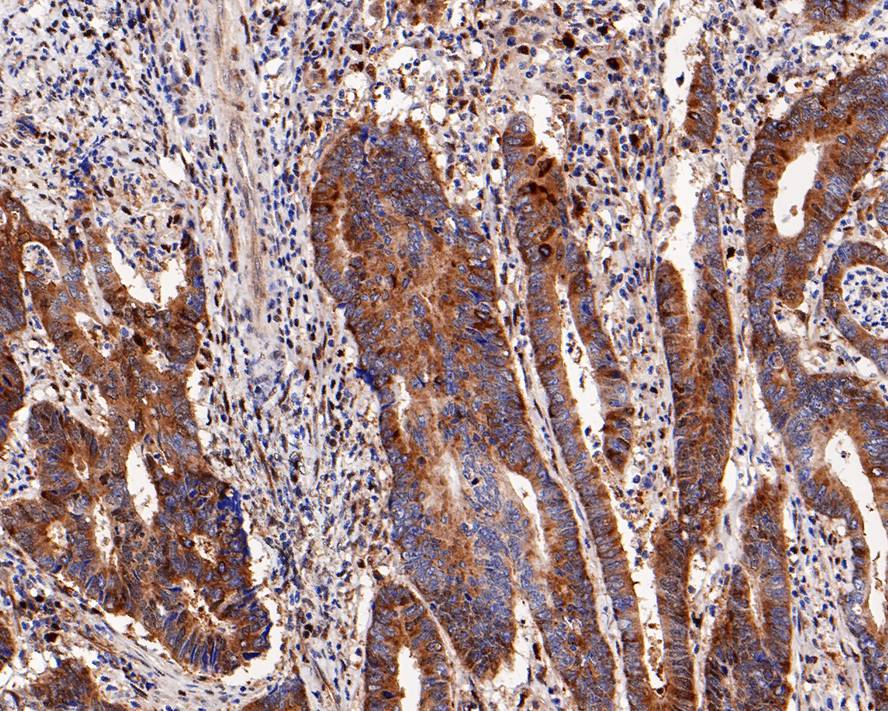 p62/SQSTM1 Antibody (PS00-61)