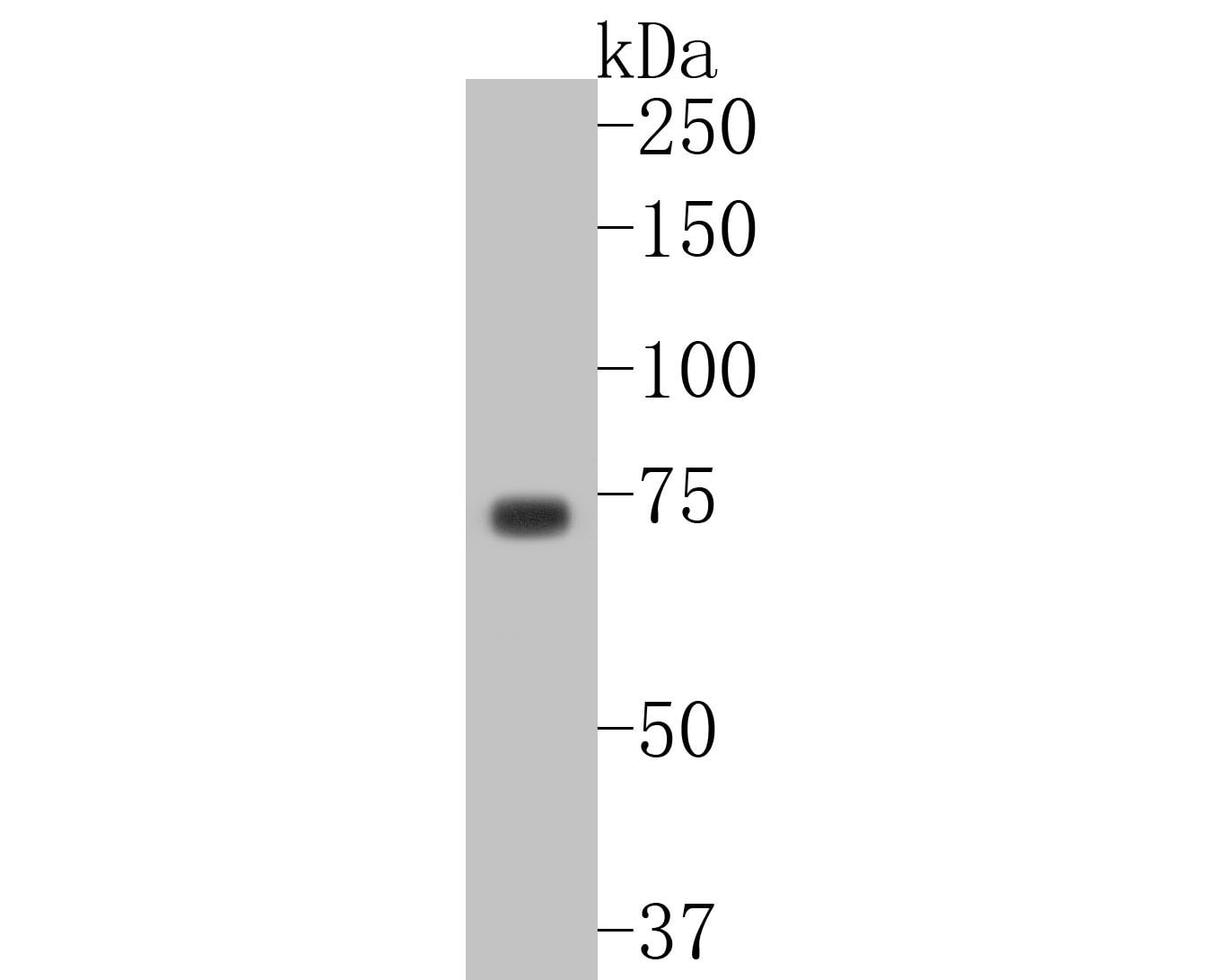 p63/TP73L Antibody (SC06-31)