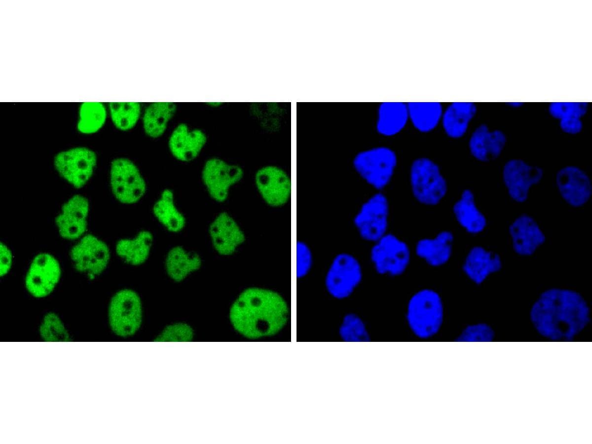 p63/TP73L Antibody (SC06-31)