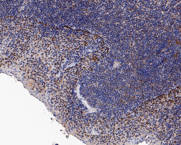 p63/TP73L Antibody (SC06-31)