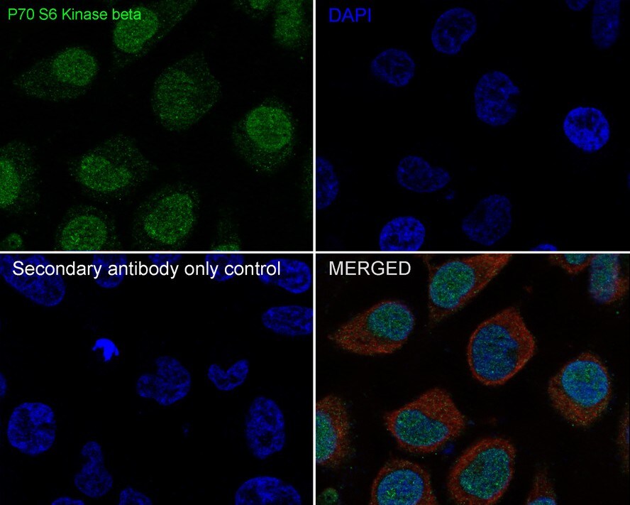 p70 S6 Kinase beta/S6K2 Antibody (JE35-69)