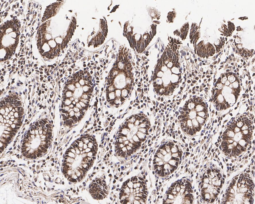 p70 S6 Kinase beta/S6K2 Antibody (JE35-69)