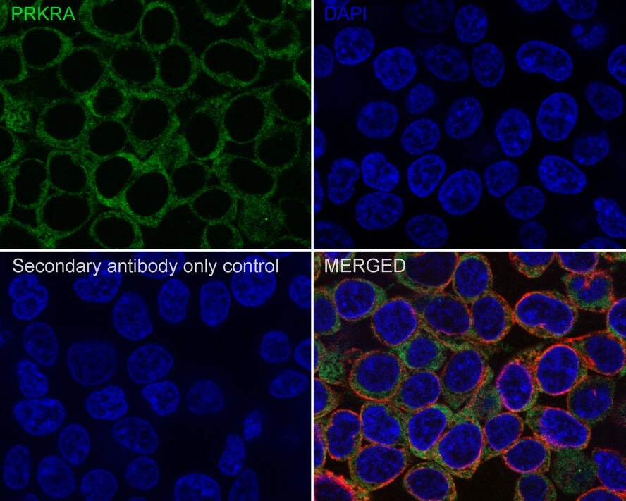 PACT Antibody (PSH02-14)