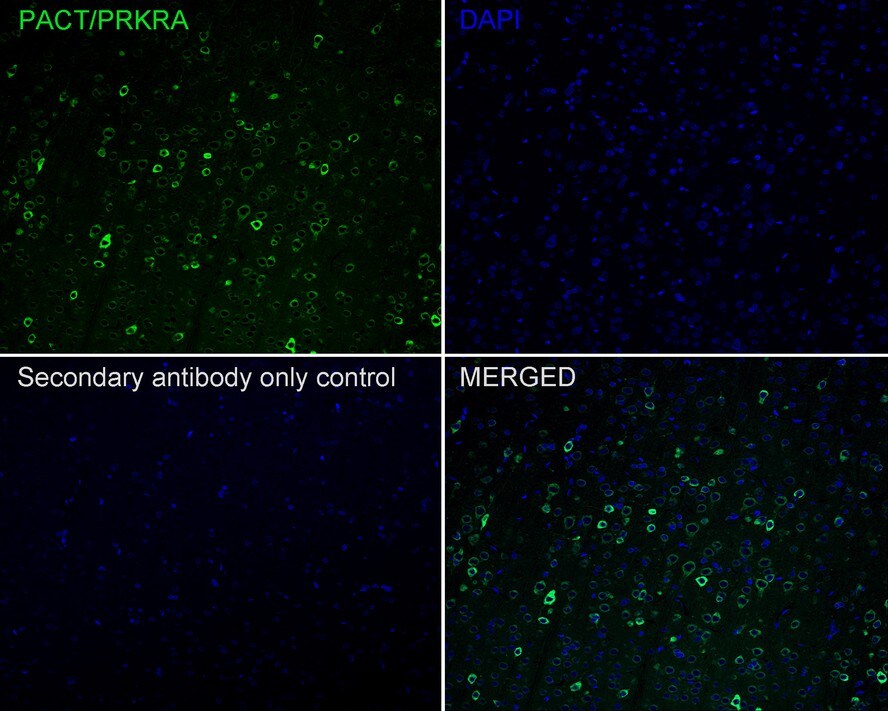 PACT Antibody (PSH02-14)
