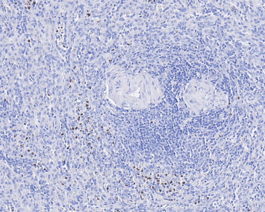 PADI4 Antibody (PSH01-33)