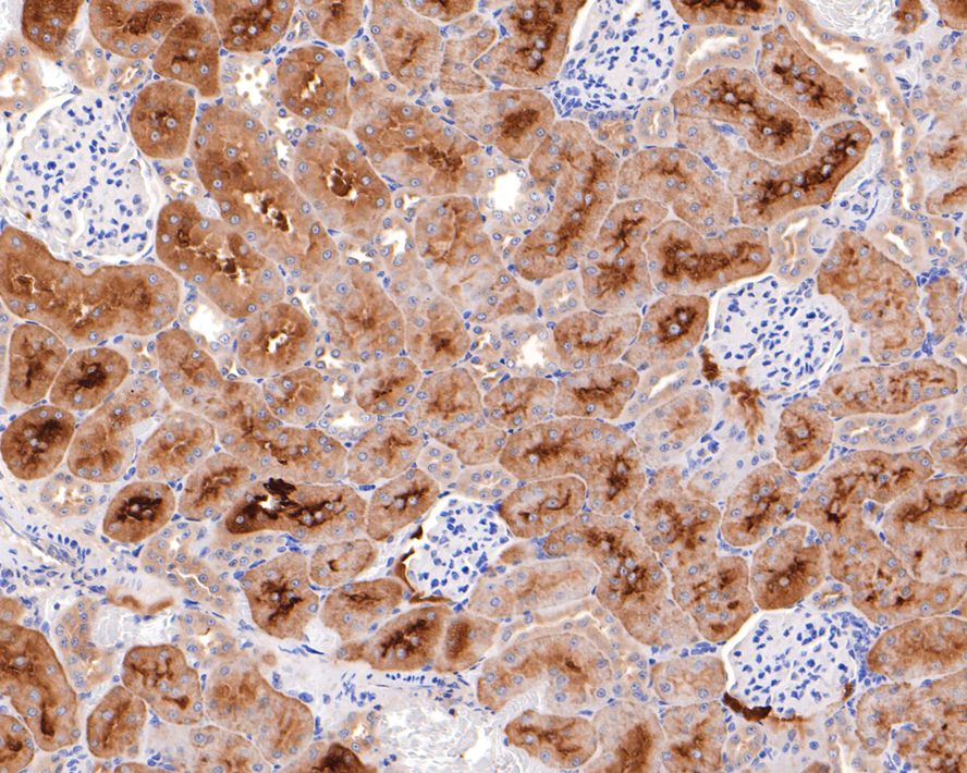 Phenylalanine Hydroxylase Antibody (JE64-47)