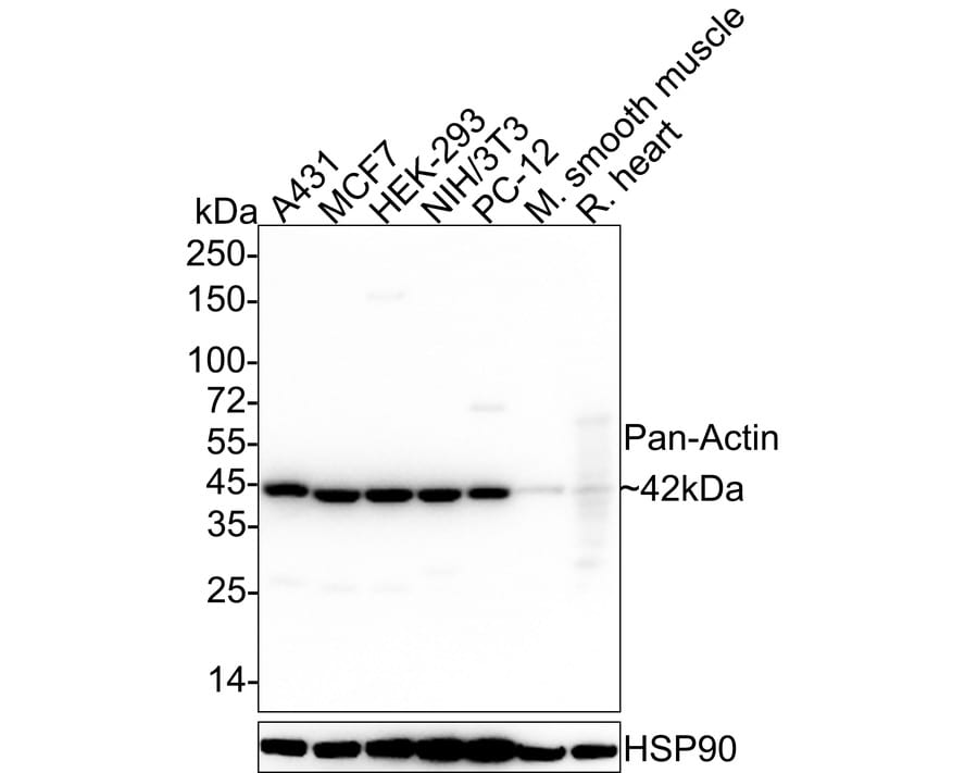 pan Actin Antibody (A2E1-R)