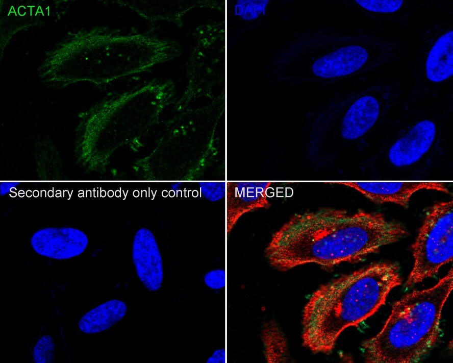 pan Actin Antibody (A2E1-R)