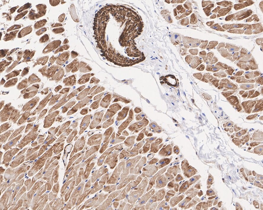 pan Actin Antibody (A2E1-R)