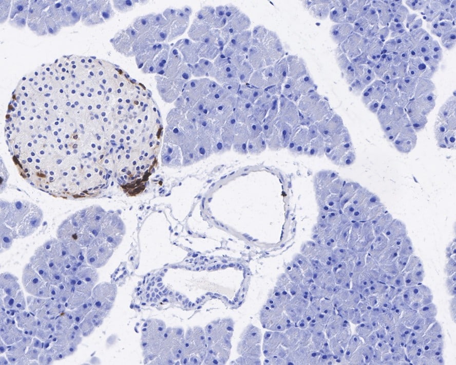 Pancreatic Polypeptide/PP Antibody (PSH0-84)