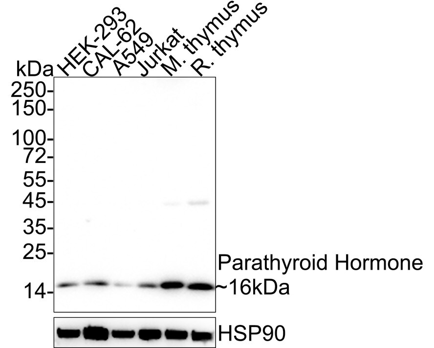 PTH Antibody (JE66-58)