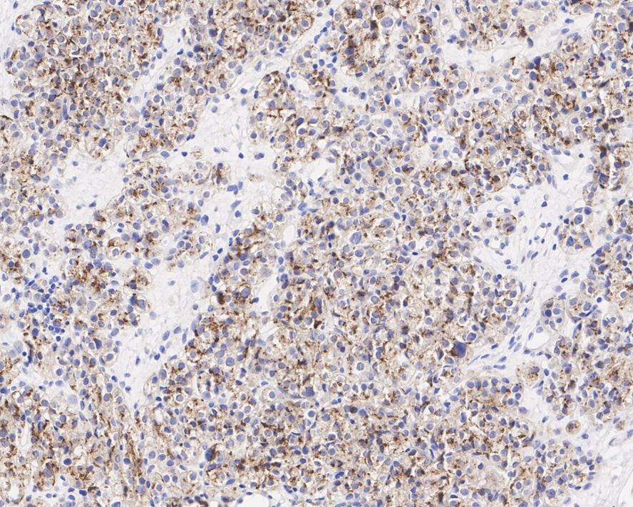 PTH Antibody (JE66-58)