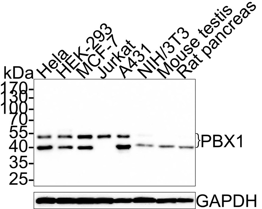 PBX1 Antibody (PSH0-24) Western Blot: PBX1 Antibody (PSH0-24) [NBP3-32720]